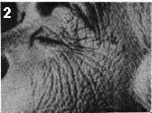 Sunbed effect on your face